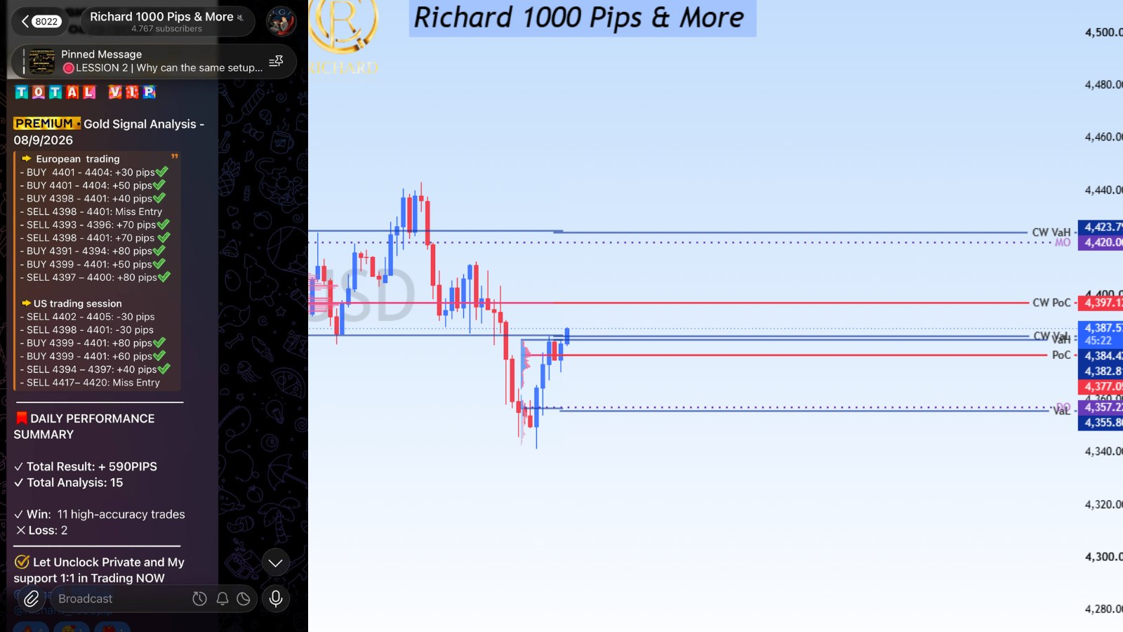 Richard 1000 Pips & More